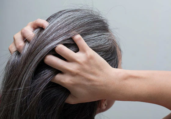 بشكل طبيعي.. هكذا يمكنكم إخفاء الشعر الأبيض صورة رقم 5