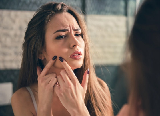 أقوى من المراهم والأدوية.. كيف تتخلص أحماض أوميغا 3 من حب الشباب؟ صورة رقم 4 أقوى من المراهم والأدوية.. كيف تتخلص أحماض أوميغا 3 من حب الشباب؟ صورة رقم 4