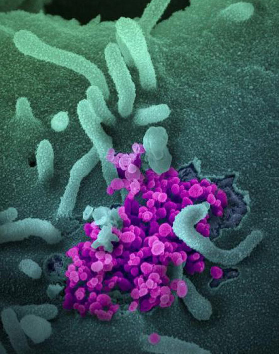 هل نحن على موعد مع وباء جديد؟.. العلماء يتخوفون من 3 فيروسات! صورة رقم 6 هل نحن على موعد مع وباء جديد؟.. العلماء يتخوفون من 3 فيروسات! صورة رقم 6