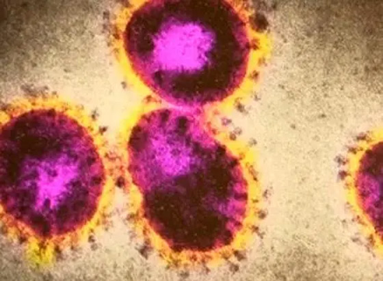 هل نحن على موعد مع وباء جديد؟.. العلماء يتخوفون من 3 فيروسات! صورة رقم 7 هل نحن على موعد مع وباء جديد؟.. العلماء يتخوفون من 3 فيروسات! صورة رقم 7