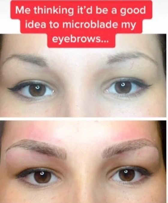 تحذر من عمل مايكروبليدنغ للحواجب لهذا السبب صورة رقم 2