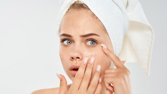 لبشرة صافية من دون حب شباب وبثور.. إليك الخطوات صورة رقم 1