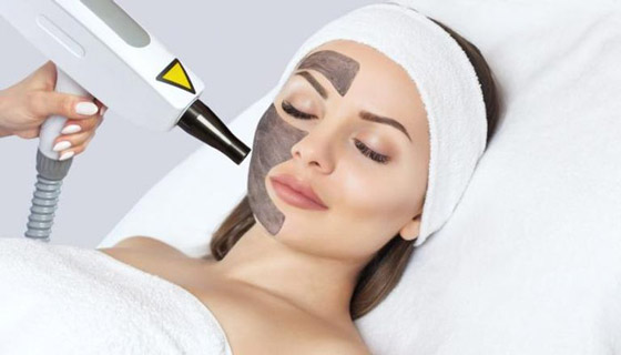 التقشير بالكربون.. مفتاح نقاء وشباب البشرة صورة رقم 1