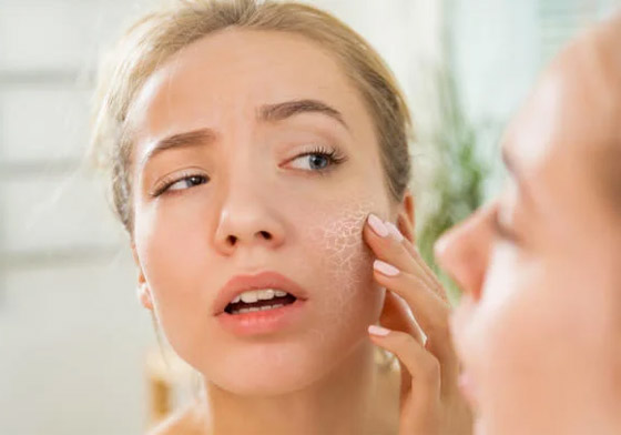 إليكم ماسك لعلاج مشاكل البشرة الجافة قبل العيد صورة رقم 1 إليكم ماسك لعلاج مشاكل البشرة الجافة قبل العيد صورة رقم 1