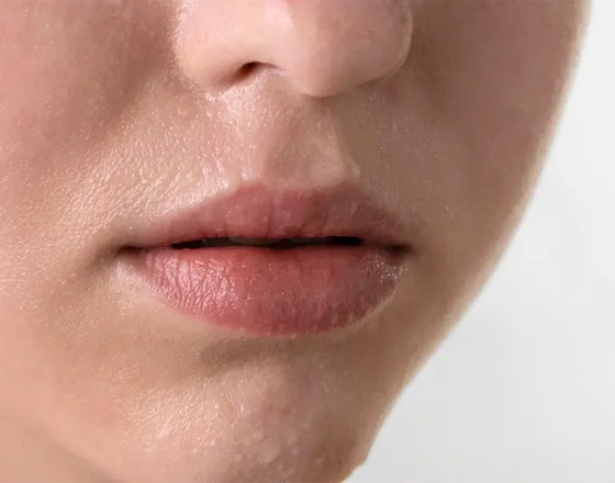 10 حيل وعلاجات تساعد في الحد من الإفراط بتعرق الوجه صيفا صورة رقم 2 10 حيل وعلاجات تساعد في الحد من الإفراط بتعرق الوجه صيفا صورة رقم 2