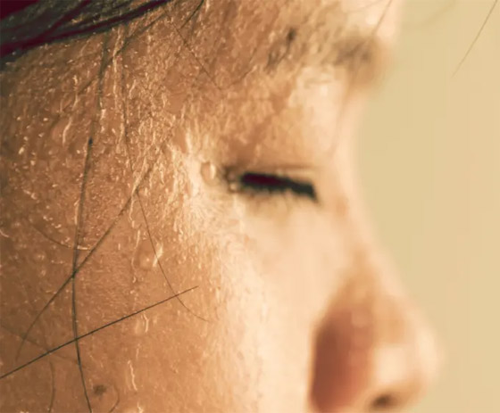 10 حيل وعلاجات تساعد في الحد من الإفراط بتعرق الوجه صيفا صورة رقم 4 10 حيل وعلاجات تساعد في الحد من الإفراط بتعرق الوجه صيفا صورة رقم 4