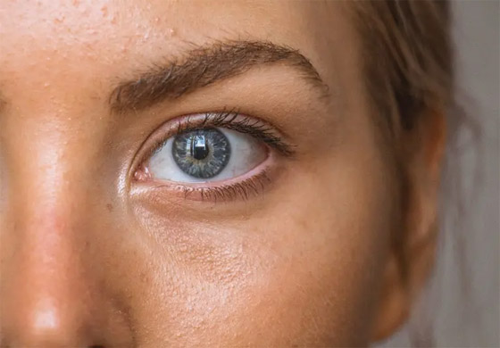 هكذا تتخلصون من الزيوان الأبيض الذي يغزو البشرة صورة رقم 3 هكذا تتخلصون من الزيوان الأبيض الذي يغزو البشرة صورة رقم 3