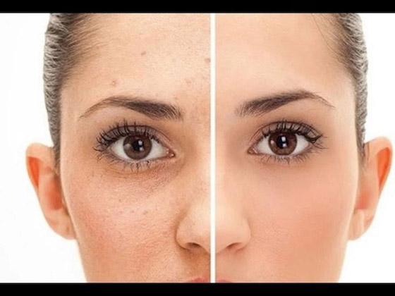 ما هو السن المناسب للبدء بوضع الكريمات المضادة للشيخوخة؟ صورة رقم 4