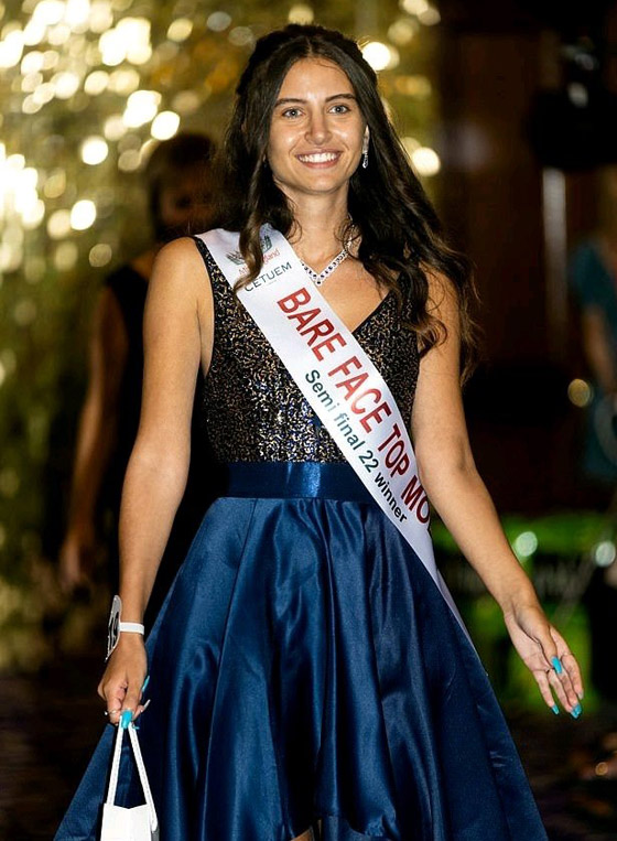 صور: أول متسابقة بالتاريخ تُشارك بلا مكياج في مسابقة ملكة جمال إنجلترا صورة رقم 5 صور: أول متسابقة بالتاريخ تُشارك بلا مكياج في مسابقة ملكة جمال إنجلترا صورة رقم 5