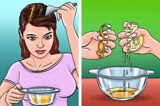 اليكم افضل 5 وصفات لمكافحة قشرة الرأس صورة رقم 2 اليكم افضل 5 وصفات لمكافحة قشرة الرأس صورة رقم 2