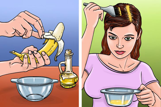 اليكم افضل 5 وصفات لمكافحة قشرة الرأس صورة رقم 4 اليكم افضل 5 وصفات لمكافحة قشرة الرأس صورة رقم 4