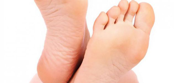 وصفتان طبيعيتان لعلاج تشقق الكعبين صورة رقم 6