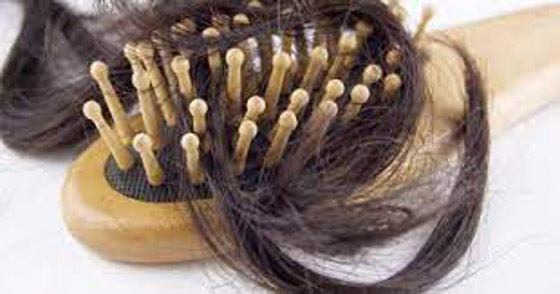لا تقلقي من تساقط الشعر.. فهذه أفضل العلاجات المنزلية صورة رقم 4