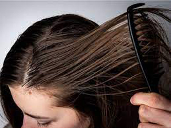 6 أسباب تجعل شعركِ دهنياً صورة رقم 5