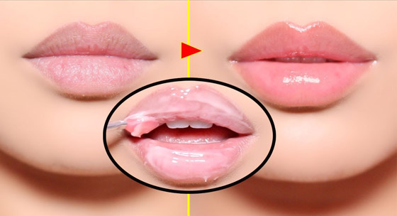 إليكم طرق علاج تشقق الشفاه وجفافها في الشتاء صورة رقم 4