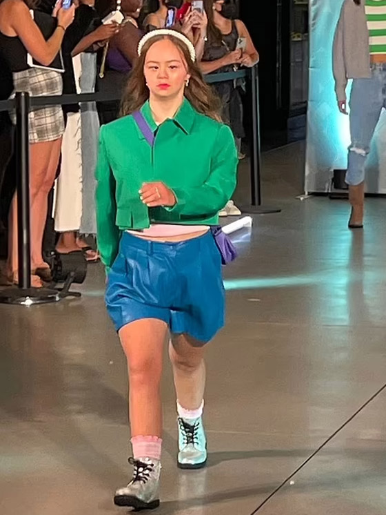 مراهقة مصابة بمتلازمة 