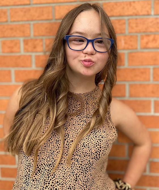 مراهقة مصابة بمتلازمة 