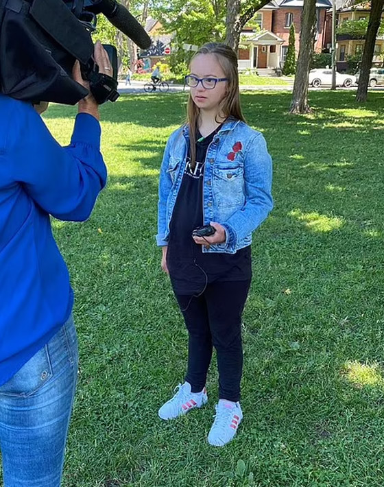 مراهقة مصابة بمتلازمة 