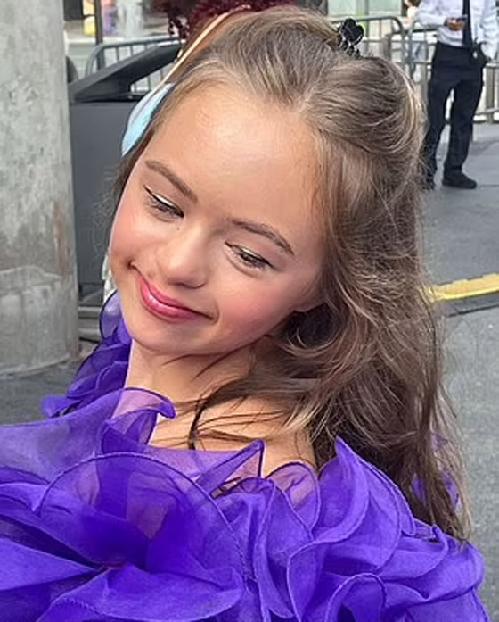 مراهقة مصابة بمتلازمة 