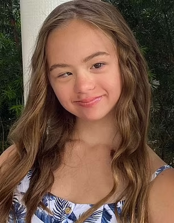 مراهقة مصابة بمتلازمة 