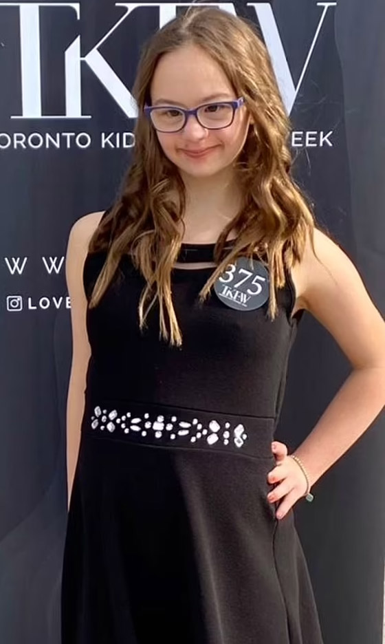 مراهقة مصابة بمتلازمة 