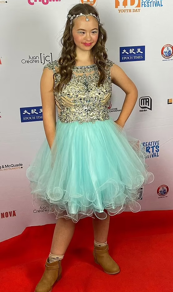 مراهقة مصابة بمتلازمة 