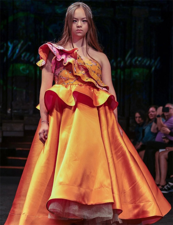 مراهقة مصابة بمتلازمة 