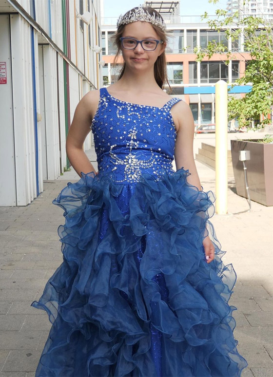 مراهقة مصابة بمتلازمة 