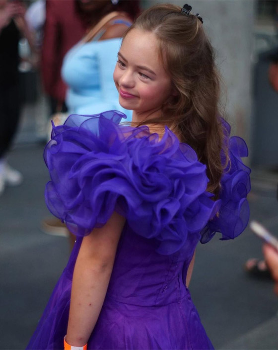 مراهقة مصابة بمتلازمة 