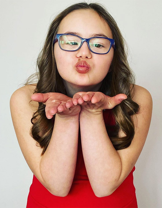 مراهقة مصابة بمتلازمة 