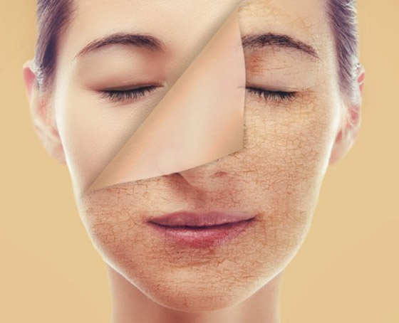 هل تعرفونها.. مكونات لا غنى عنها لنضارة وشباب البشرة؟ صورة رقم 4