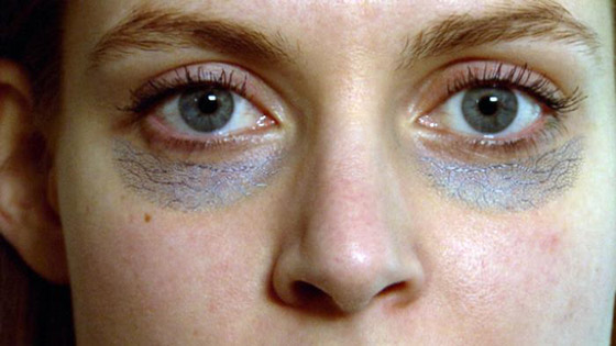 تقليل الملح إحداها.. طرق طبيعية للتخلص من الهالات السوداء صورة رقم 2