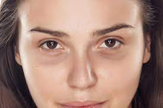 تقليل الملح إحداها.. طرق طبيعية للتخلص من الهالات السوداء صورة رقم 5