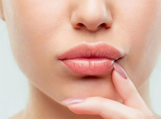 تخلصوا من تشققات الشفايف في الشتاء بسرعة وخلطة سهلة صورة رقم 4