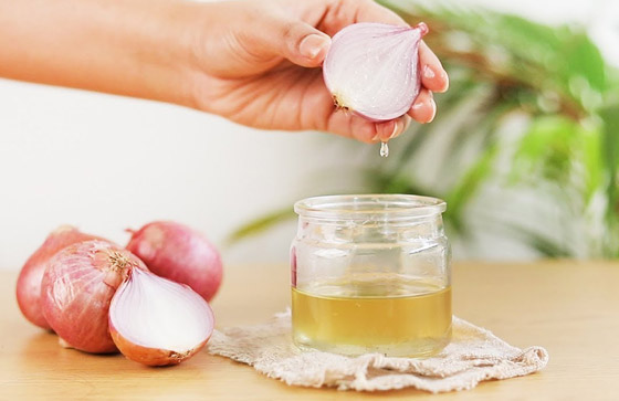 يعالج تساقط وتلف الشعر.. فوائد مذهلة لزيت البصل وطرق تحضيره بالمنزل صورة رقم 2 يعالج تساقط وتلف الشعر.. فوائد مذهلة لزيت البصل وطرق تحضيره بالمنزل صورة رقم 2