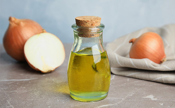 يعالج تساقط وتلف الشعر.. فوائد مذهلة لزيت البصل وطرق تحضيره بالمنزل صورة رقم 4 يعالج تساقط وتلف الشعر.. فوائد مذهلة لزيت البصل وطرق تحضيره بالمنزل صورة رقم 4