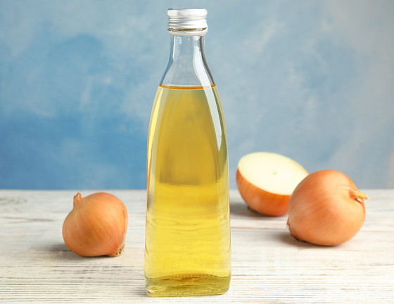 يعالج تساقط وتلف الشعر.. فوائد مذهلة لزيت البصل وطرق تحضيره بالمنزل صورة رقم 5 يعالج تساقط وتلف الشعر.. فوائد مذهلة لزيت البصل وطرق تحضيره بالمنزل صورة رقم 5