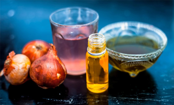 يعالج تساقط وتلف الشعر.. فوائد مذهلة لزيت البصل وطرق تحضيره بالمنزل صورة رقم 3 يعالج تساقط وتلف الشعر.. فوائد مذهلة لزيت البصل وطرق تحضيره بالمنزل صورة رقم 3