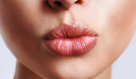 إليكم وصفة الكركم لعلاج تشقق الشفاه في فصل الشتاء صورة رقم 5 إليكم وصفة الكركم لعلاج تشقق الشفاه في فصل الشتاء صورة رقم 5