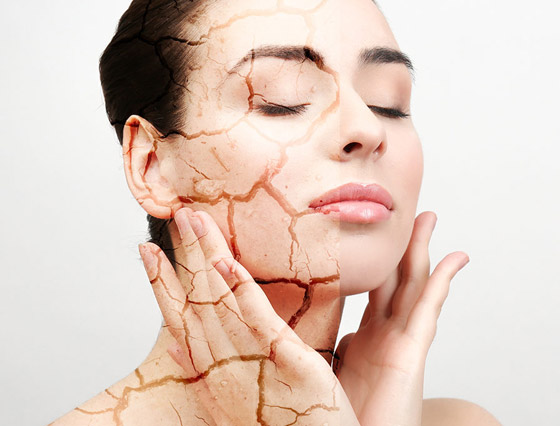 قللوا عدد مرات الاستحمام.. أسباب جفاف الجلد وطرق علاجه صورة رقم 2