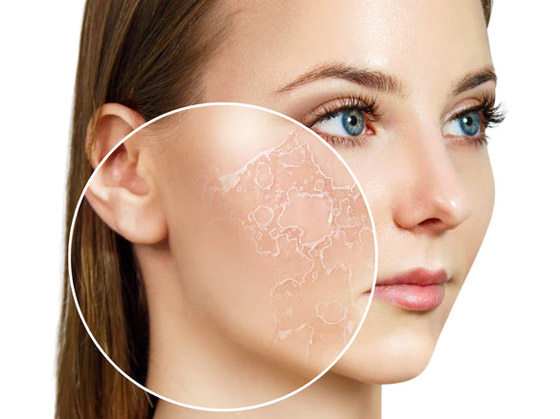 قللوا عدد مرات الاستحمام.. أسباب جفاف الجلد وطرق علاجه صورة رقم 3