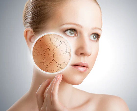 قللوا عدد مرات الاستحمام.. أسباب جفاف الجلد وطرق علاجه صورة رقم 6