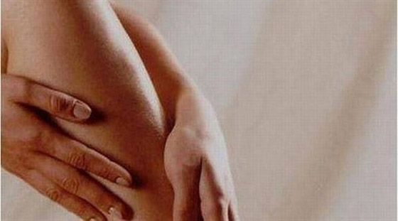 الأوردة العنكبوتية تفسد جمال سيقانك؟ هكذا تتخلصين منها صورة رقم 5