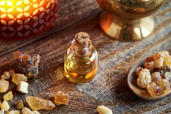 زيوت أساسية تخفف آلام «الصداع النصفي» صورة رقم 2