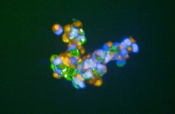 تعيد نمو الأعصاب.. 