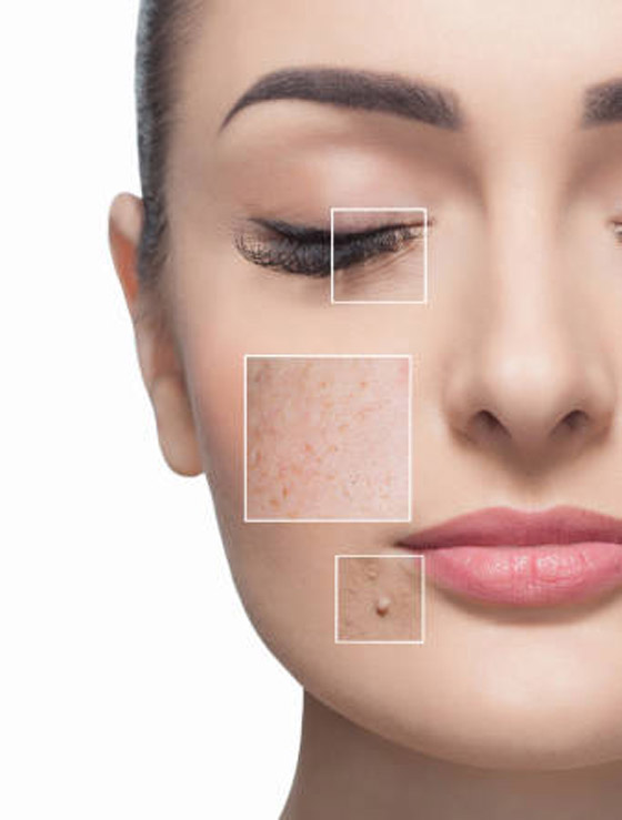 ما المكونات التي أثبتت فعاليتها في علاج البقع الداكنة؟ صورة رقم 6