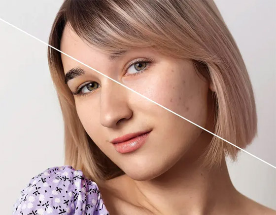 ما المكونات التي أثبتت فعاليتها في علاج البقع الداكنة؟ صورة رقم 4