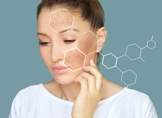 ما المكونات التي أثبتت فعاليتها في علاج البقع الداكنة؟ صورة رقم 5