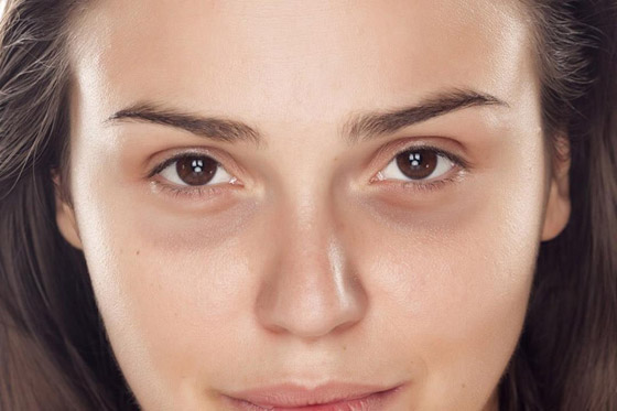 للتخلص من الهالات السوداء.. أفضل أنواع كريمات العيون بفيتامين (سي) صورة رقم 1