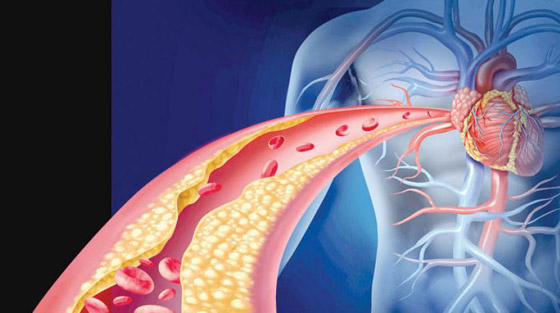 5 نصائح بسيطة تخفض الكوليسترول في جسمك صورة رقم 8